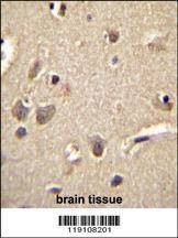 Anti-S100A1 (C-term) Antibody