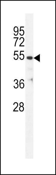 Anti-TBB1 (N-term) Antibody