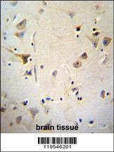 Anti-AGBL5 (N-term) Antibody