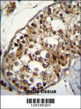 Anti-Mouse NUP160 (Center) Antibody