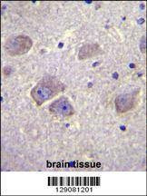 Anti-WDR27 (N-term) Antibody