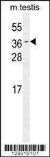 Anti-Mouse ODF3 (C-term) Antibody