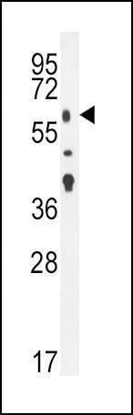 Anti-TGFBR2 (N-term) Antibody