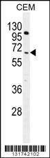 Anti-COL8A2 (C-term) Antibody