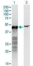 Anti-BNIP2 Antibody