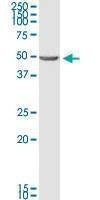 Anti-BNIP2 Antibody