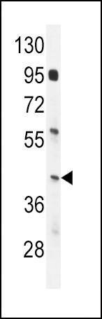 Anti-IRF9 (N-term) Antibody