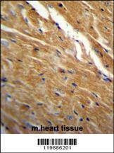 Anti-TBC1D13 (Center) Antibody