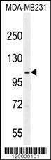Anti-SEMA3G (Center) Antibody