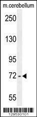 Anti-ZBT24 (N-term) Antibody