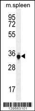 Anti-Mouse TP53INP1 (C-term) Antibody