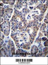 Anti-Mouse TP53INP1 (C-term) Antibody