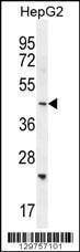 Anti-SH2D4B (C-term) Antibody