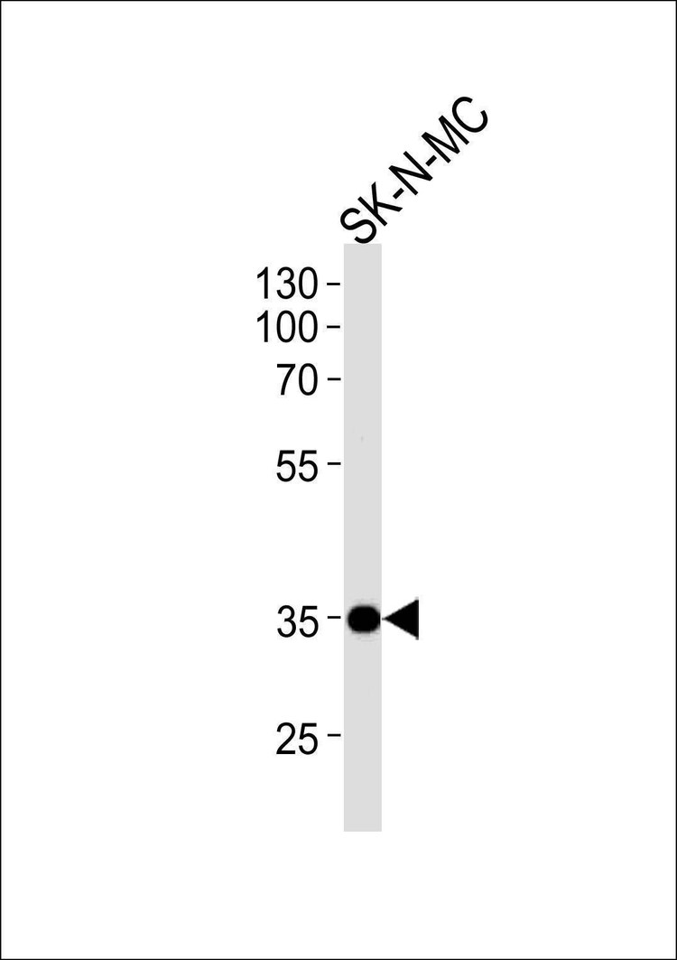 Anti-NKX1-1 (Center) Antibody