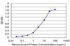Anti-BRD3 Antibody
