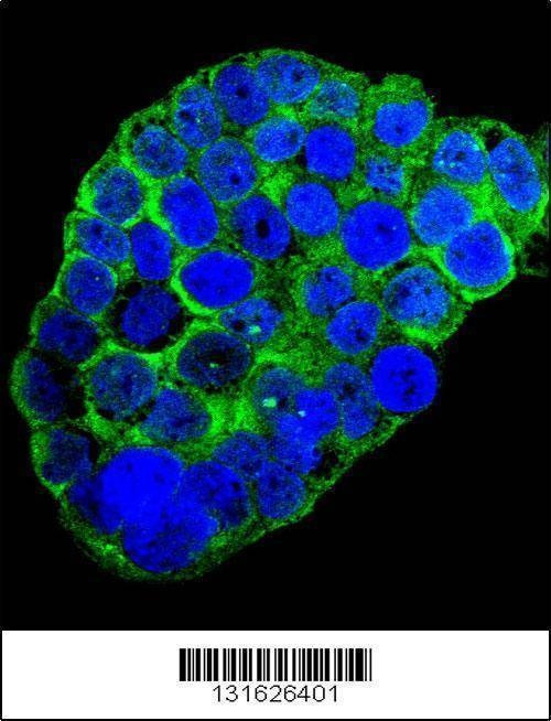 Anti-C1QC (Center) Antibody