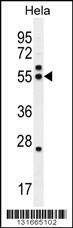 Anti-TBB8B (C-term) Antibody
