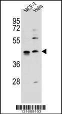 Anti-ZNF384 (C-term) Antibody