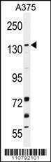 Anti-JMJD2B (N-term) Antibody