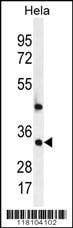 Anti-MED7 (Center) Antibody