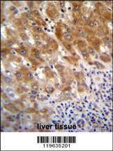 Anti-FAH (N-term) Antibody
