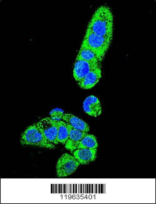 Anti-FAH (N-term) Antibody