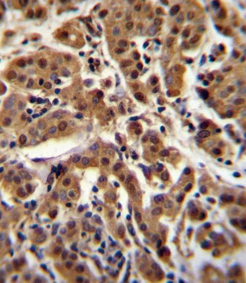 Anti-AKT1 (C-term T450) Antibody