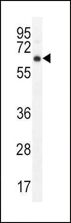 Anti-AKT1 (C-term T450) Antibody