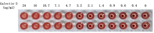 Recombinant Human Galectin-3 (LGALS3) Protein