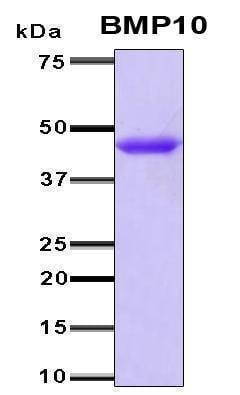 Recombinant Human BMP10 Protein