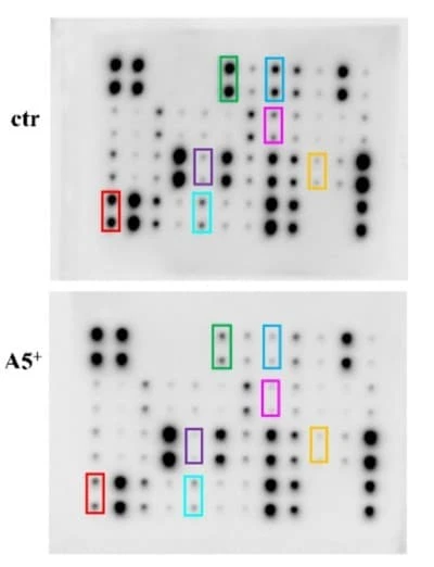 Figure adapted from Pacifici et al., Cells, 2023. AAH-INF-1-2