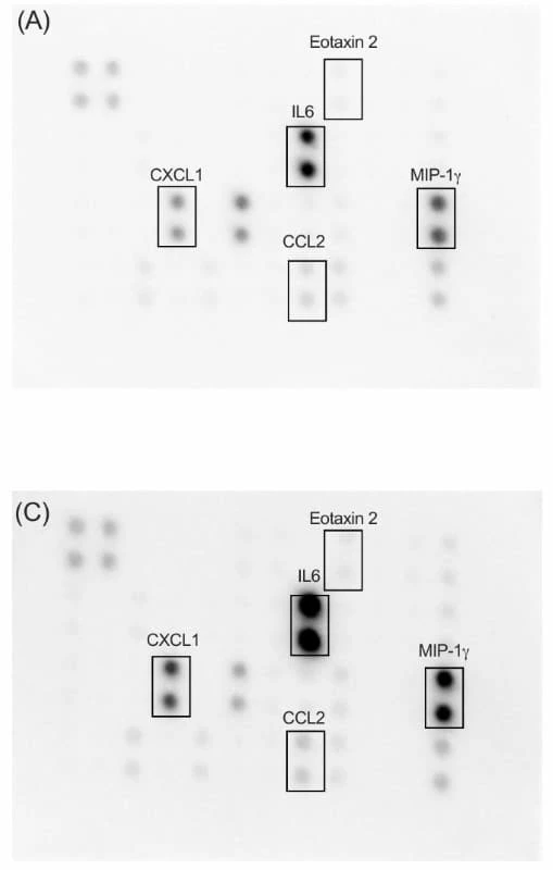 Figure adapted from Sompel et al., Cancer Prevention Research, 2023.