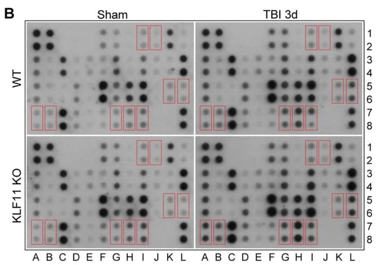 Figure adapted from Zhou et al., Journal of Neuroinflammation, 2022.