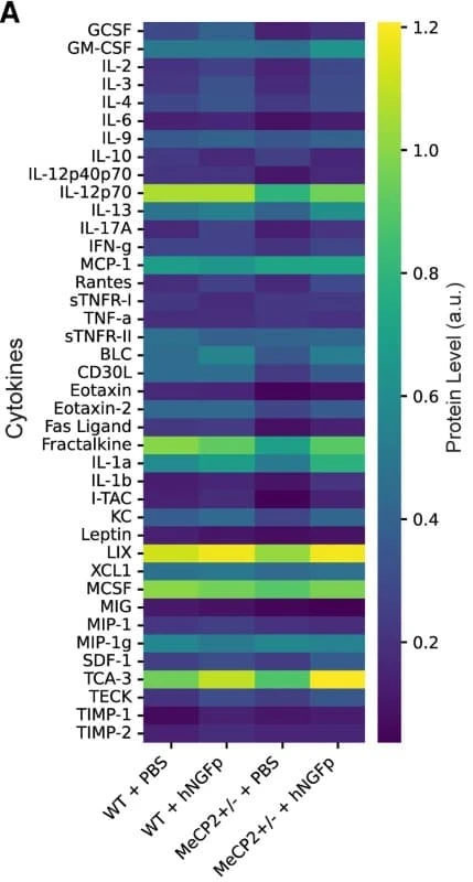 Figure adapted from Tiberi et al., Brain, 2024.