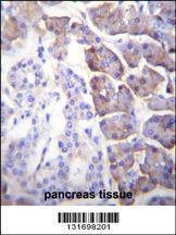 Anti-CPB1 (N-term) Antibody