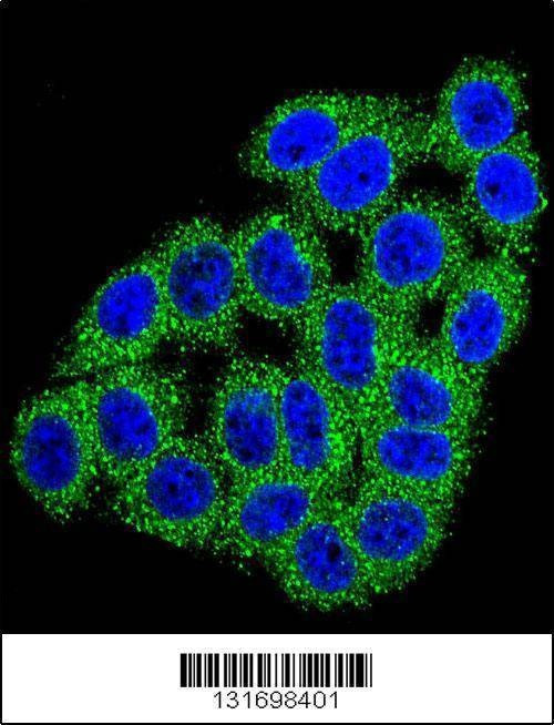 Anti-CPB1 (N-term) Antibody