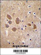 Anti-AP1M1 (Center) Antibody