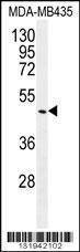 Anti-GDF5 (C-term) Antibody