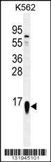 Anti-RPS19 (Center) Antibody