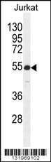 Anti-RBPJL (N-term) Antibody