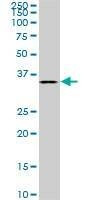 Anti-BVES Antibody