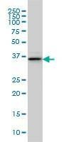 Anti-BVES Antibody
