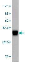 Anti-BVES Antibody