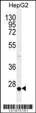 Anti-CACNG6 (Center) Antibody