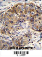 Anti-GSR (C-term) Antibody
