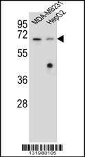 Anti-GLMN (C-term) Antibody