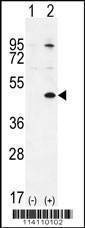 Anti-TGIF1 (Center L223) Antibody