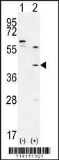 Anti-TGIF1 (Center A160) Antibody
