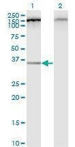 Anti-C12orf24 Antibody