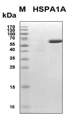 Recombinant Human HSP70-1A/1B (HSPA1A/B) Protein